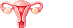 유방암