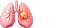 유방암